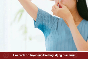 Bật mí cách trị hôi nách hiệu quả bằng phương pháp Đông Y